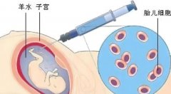 高龄试管受孕与羊膜穿刺的关系是什么?为什么要羊膜穿刺?