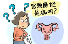 宫颈糜烂有什么症状，对女性健康威胁大