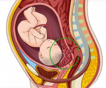 前置胎盘的最佳剖腹产时机，守护母婴安全的黄金周！