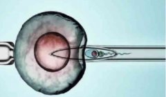 实现怀孕生育，中山私人医院供卵试管怎么样？