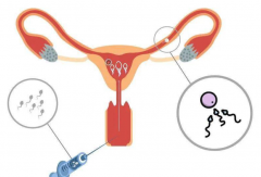 女性年龄对人工授精影响大吗？年纪越大成功率越低