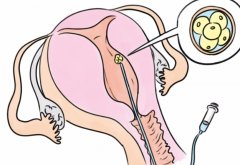 试管移植前是否需要先进行热敷暖宫？热敷对暖宫的作用