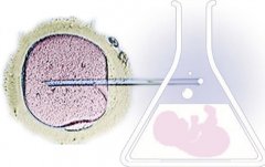 东莞做三代试管婴儿一次失败的医院原因分析及风险