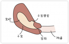 子宫憩室2cm，疤痕4mm，试管婴儿成功率有多高?