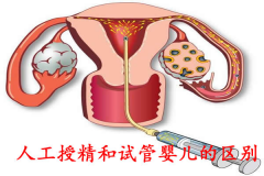 一文读懂人工授精和试管婴儿区别，有什么不一样一看便知