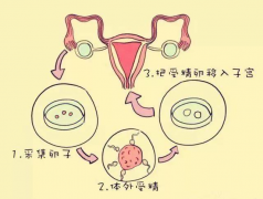 上饶试管婴儿能选性别吗？三代试管全了解