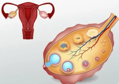 影响卵巢排卵的几大因素，长期不排卵主要由这些原因引起！