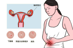 输卵管异常可以试试试管婴儿，比自然怀孕成功率高