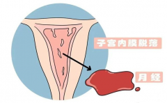 女性能排卵就能做试管婴儿？还需要满足以下条件！