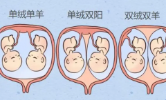 什么是试管双胎单绒、双绒？来看二者有什么区别