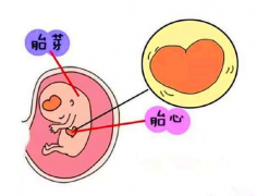 胎芽大小有异常要早点处理，偏大偏小都不行！