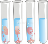 生殖专家解答：哪种染色体问题不能做试管移植？