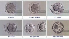 胚胎融合能否成功？深入分析影响因素，助你把握成功关键！