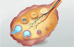 如何避免出现空卵泡？做好这几点很重要！