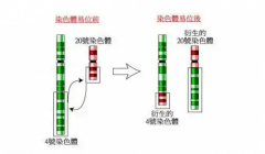 男性染色体平衡易位影响怀孕，容易导致流产或生化妊娠