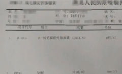 试管婴儿取卵前为什么要测测hCG？原因主要有三个