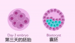 试管婴儿养囊和移植囊胚并不是万无一失，也存在以下风险！