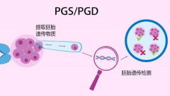 第一代试管包生男孩费用与条件：如何选择最适合的方案？