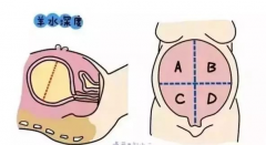 怀孕羊水深度多少正常？羊水过多或者过少都有危害！
