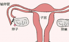 做试管要不要查输卵管？什么情况下需要检查？