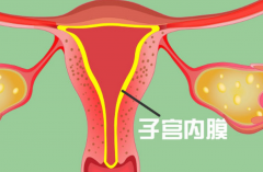 子宫内膜炎能做试管婴儿吗？治疗后有怀孕希望！