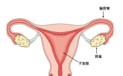输卵管炎症要赶紧治，对试管婴儿影响很大！