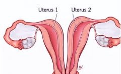 女性双子宫能尝试试管婴儿吗？有没有风险？