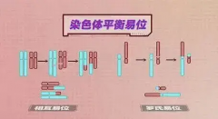 盘点常见染色体平衡易位，哪些因素导致胎儿染色体异常？