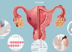 什么是子宫内膜异位症？有哪些常见表现？